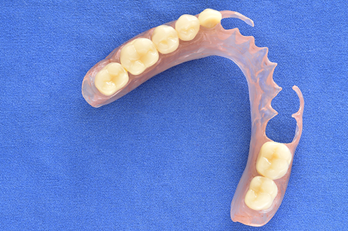 Removable Dentures in Concord MA